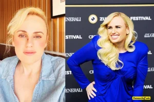 Rebel Wilson’s Mid-Flight Surgery After On-Set Nose Injury